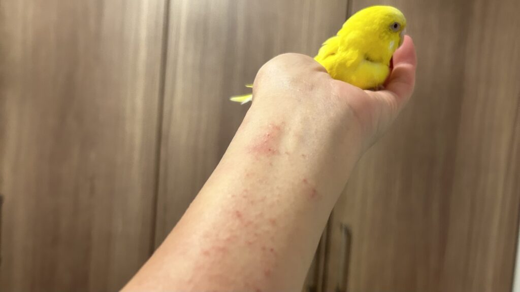 小鳥と湿疹のでている腕